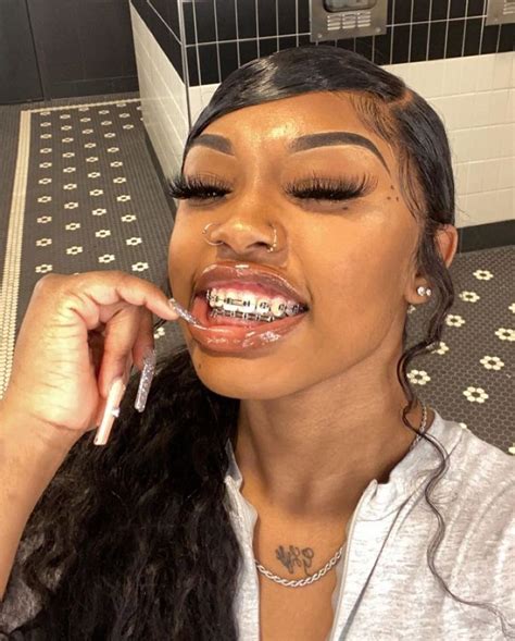 blue braces on black girls.